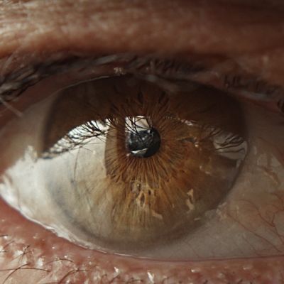 Eye Moises